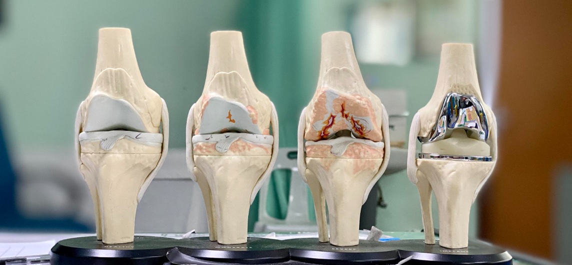 Przekrój kolan symbolizujący systemy do endoplastyki Meril Poland w ofercie MedTech Solutions