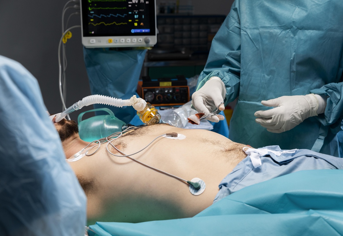 Shockwave C2 Aero Coronary IVL Catheter Johnson & Johnson